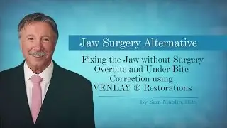 Non-Surgical Overbite & Underbite Fix with VENLAY&reg; Restorations