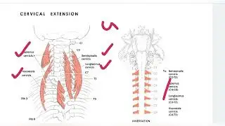 manual Muscle testing  neck (cervical, capital and combined) extension grad 5 to 0