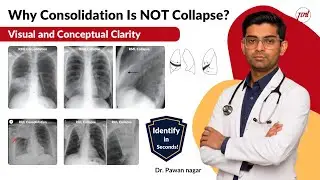 Consolidation vs Collapse &mdash; Don&rsquo;t Confuse These Again! | Dr Pawan nagar