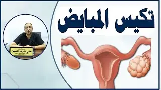 أهم أسباب و أعراض تكيس المبايض وطريقة علاجها