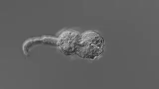 Dance of the Cercaria (a Trematode larva, xiphidiocercaria)