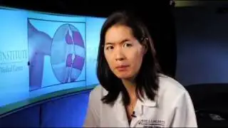 Hyperhidrosis