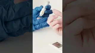 Diabetes & Kidney Damage: Right Tests at the Right Time | Dr Jitendra Kumar | Kidney Checkup Guide