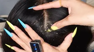 Deep Scalp Tingle Reset ASMR 🌙 | Slow Scratching, Flake Lift & Sleep Calm #DN535