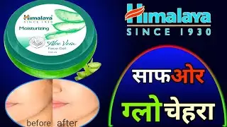 Moisturizing Aloe Vera Face Gel || Smooth Glowing Skin ||