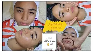 #نيطوياج_البشرة تنظيف الوجه في البيت نتيجة❤️وااو احسن من الصالون👌👍