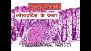 कोलाइटिस के प्रकार/TYPES OF COLITIS WITH CAUSES..