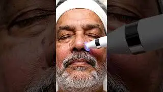 &ldquo;Robot Vacuum Facial 😱 | Oddly Satisfying Pore Extraction ASMR&rdquo;