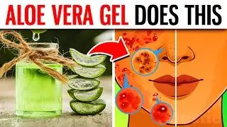10 POWERFUL Benefits Of Aloe Vera Gel