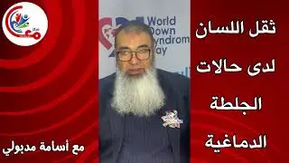 #ثقل #اللسان  لدي الاشخاص ممن لديهم #جلطة دماغية Slurred #tongue in people who have had a #stroke e