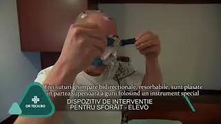 Dispozitiv pentru sforăit - Elevo - DrTech.ro