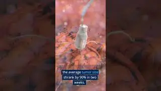 New battery wraps around tumors to starve cancer cells of oxygen in mice