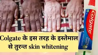 Skin whitening colgate toothpaste for hand whitening instant at home remedies | #skinwhitening