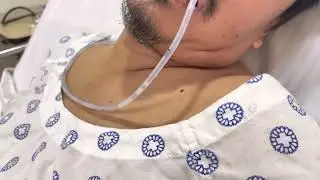 Stroke Recovery Feeding using NGT