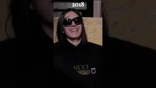 Как изменился рэпер FACE