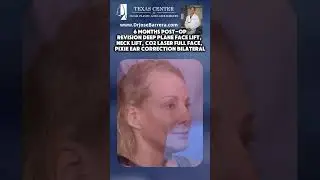 Revision Deep Plane Facelift | Neck Lift | Full Face CO2 Laser | Bilateral Pixie Ear Correction
