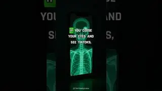 If you close your eyes and see TikToks, your brain is rewiring #shorts #biohacking