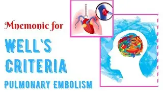 Well's Criteria in Pulmonary Embolism. Mnemonic by MedSurvival