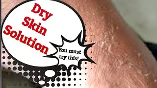 Dry Skin Solution | Smooth Skin results