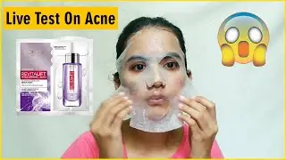 L'Or&eacute;al Paris Revitalift HYALURONIC ACID FRESH MIX SERUM SHEET MASK, 33 gm | Live Test On Acne 😮😱