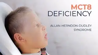 MCT8 Deficiency - Mode of Disorder
