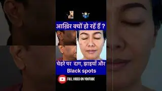 How to remove dark spot at home| the real fact #blackspot  #hyperpigmentation  #shorts #darkspots