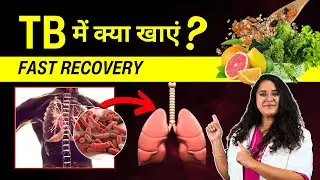 TB Me Kya Khana Chahiye? TB Diet Chart In Hindi