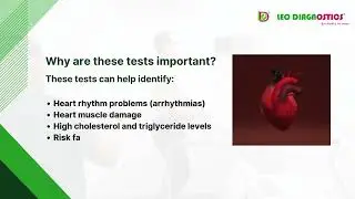 Cardiac Profile Test