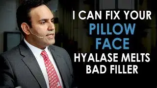 I Can Fix Your Pillow Face - Hyalase Melts Dermal Fillers Quickly