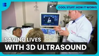 Life-Saving 3D Ultrasound Tech - Cool Stuff: How It Works - S01 EP05 - Science Documentary