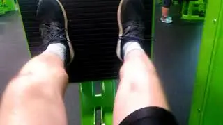 More 410lb squats on the same clubbed feet.