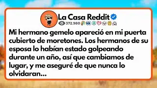 Mi hermano gemelo apareci&oacute; en mi puerta cubierto de moretones. Los hermanos de su esposa lo....