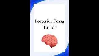 Neurosurgery Long Cases- Posterior Fossa and Pineal Region Tumor