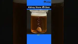Kidney stones and beer | Do Beer dissolve kidney stones? #kidneystones