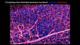 High-Throughput Electron Microscopy (Transcending Biology)