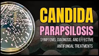 Candida parapsilosis: Symptoms, Diagnosis, and Effective Antifungal Treatments