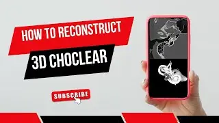 How to reconstruct CT Scan 3D Choclear/ear/Teknik rekontruksi choclear