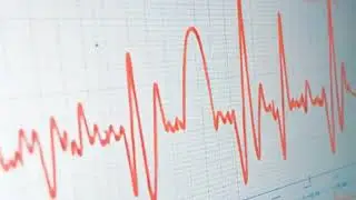 #ECG #HeartHealth #MedicalExplainer #HealthKnowledge