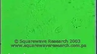 ZAPPER PROMO