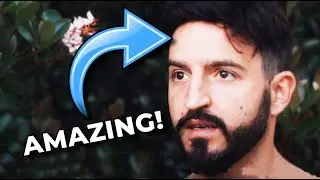 Stage PERFORMER'S Hair System Changed HIS LIFE! 👀 [This hair restoration story is awesome]