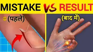 Stop Hangnail Peeling |Stop Peeling Hangnail |Hangnail | Peeling Hangnail |Hangnails|Princegupta6331