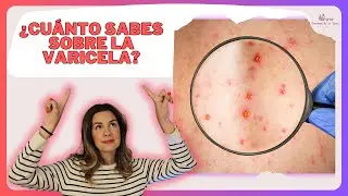Varicela en niños: síntomas, complicaciones y vacuna