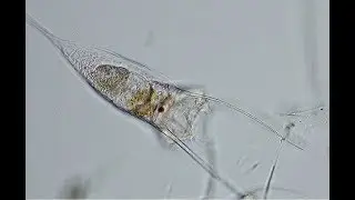 R&auml;dertierchen, Einhornr&auml;dertierchen (Kellicottia longispina)