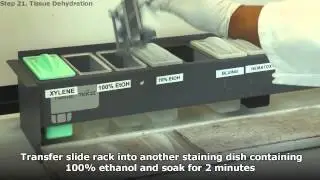 Tissue Dehydration