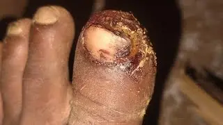 “Kaam karte waqt pair mein chot lag gayi | Phir bhi rukna nahi 💔💪”