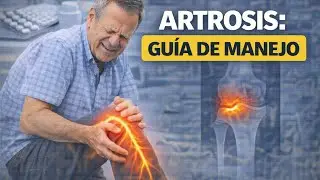Artrosis: Guia de manejo