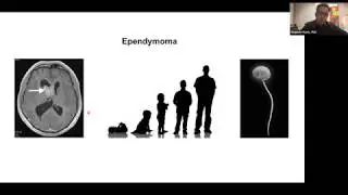 Pediatric Brain Cancers as Epigenetic Diseases