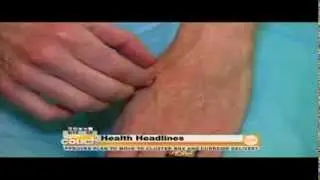 Fixing Zombie Hands with Dermal Fillers in NJ