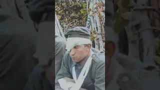 Wounded German POWs in 1918 - Restored Footage