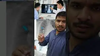 chest x-ray spot problem solution